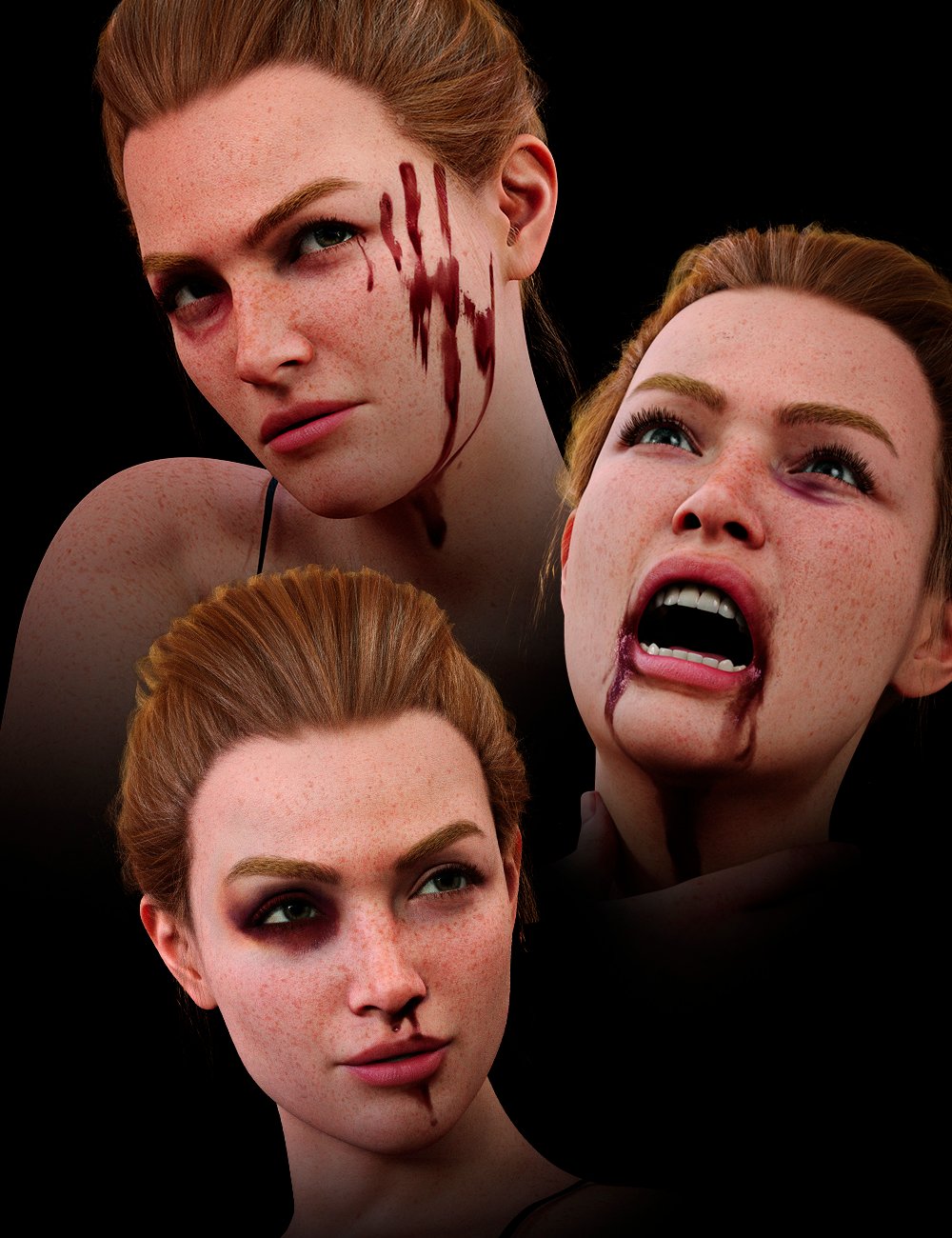 lafacialbruisesforgenesis900maindaz3d 1726555590